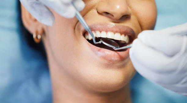 Best Broken or Chipped Tooth Repair in Henderson, NV