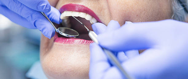 Best Emergency Wisdom Tooth Extraction in Henderson, NV